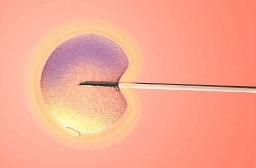 IVF behandling